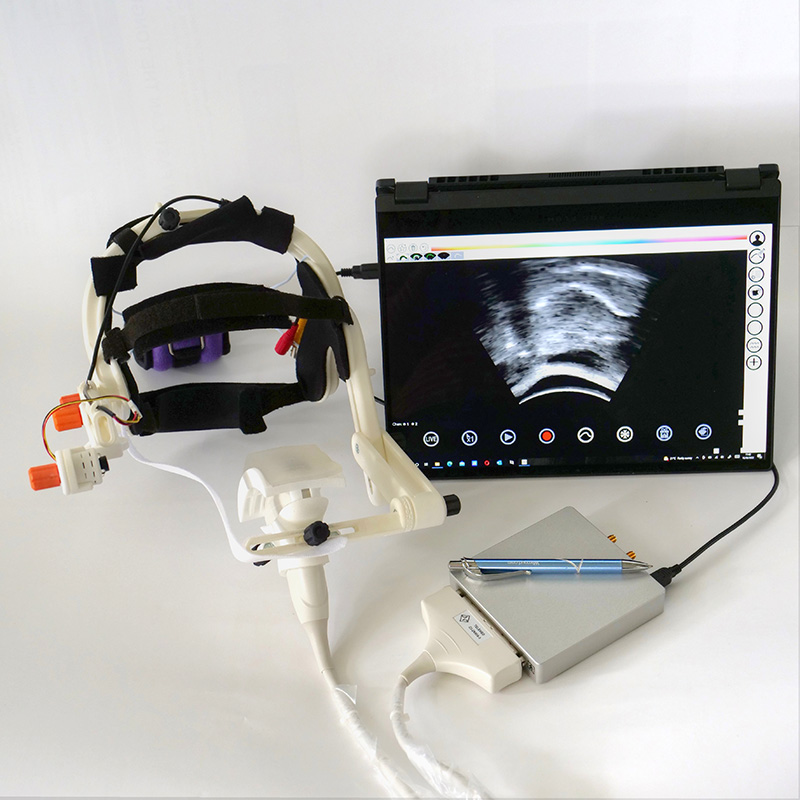 Pocket-sized micro ultrasound system